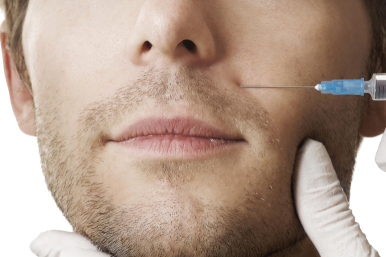 Hyaluronsäurespritze-Oberlippe-Mann Mann wird oberhalb der Lippen mit einer Hyaluronsäurespritze behandelt.